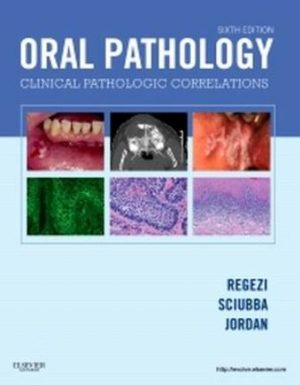 Oral Pathology 6th Edition Regezi TEST BANK