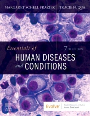 Essentials of Human Diseases and Conditions 7th Edition Frazier TEST BANK